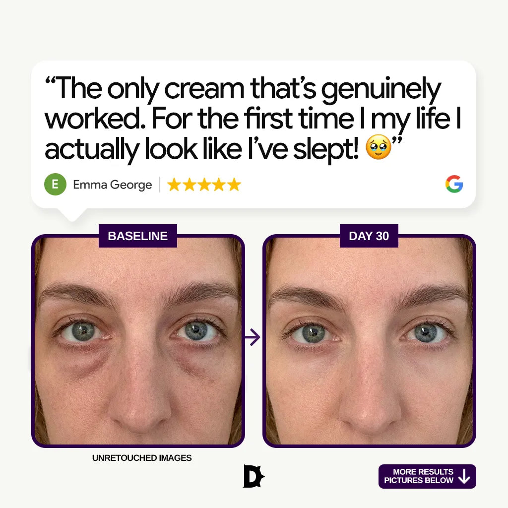 Dark Circle Cream