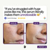 Poreless Perfection Serum