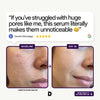 Poreless Perfection Serum